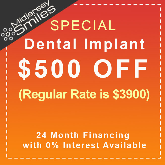 $500 off dental implants at Midjersey Smiles